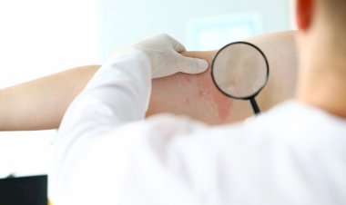 No Dia Mundial do Lúpus, médico do José esclarece sobre a doença