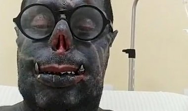 "Diabão" recebe alta após cirurgia e diz que orações o salvaram