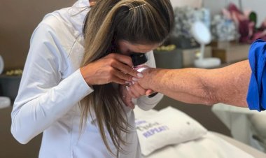 Sul tem o maior índice de câncer de pele do país; em SC são as mulheres que mais sofrem com a doença