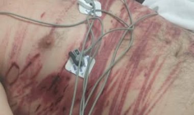 Homem leva  surra por roubar idosos em bairro de Criciúma