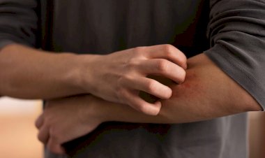 COMO LIDAR COM ALERGIAS NO VERÃO