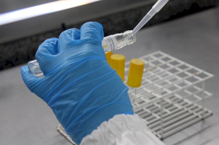 Laboratório de Microbiologia do Iparque passa por melhorias e recebe nova acreditação do Inmetro